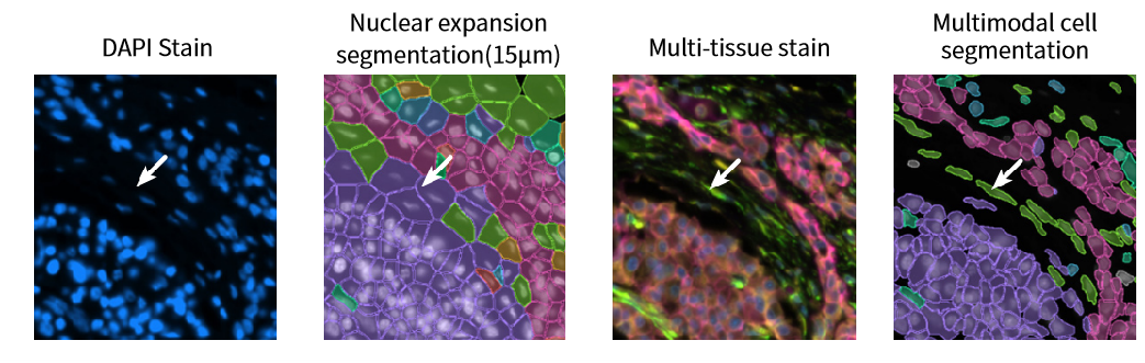 Figure_7._Improved_Accuracy_in_Irregular_Cell_Morphologies.webp