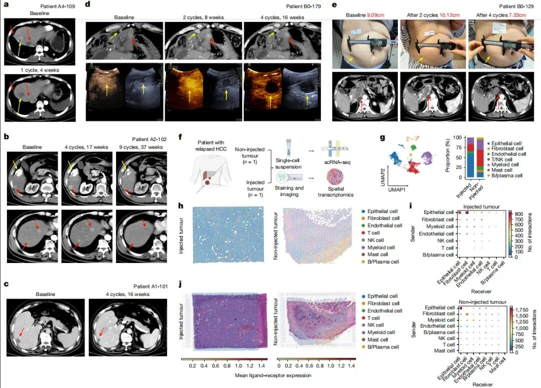 Representative_Tumor_Response_Data_from_a_Responder_Patient.webp