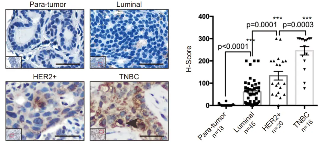 Immunohistochemical_analysis_of_TEM8_protein_in_adjacent_normal_and.webp