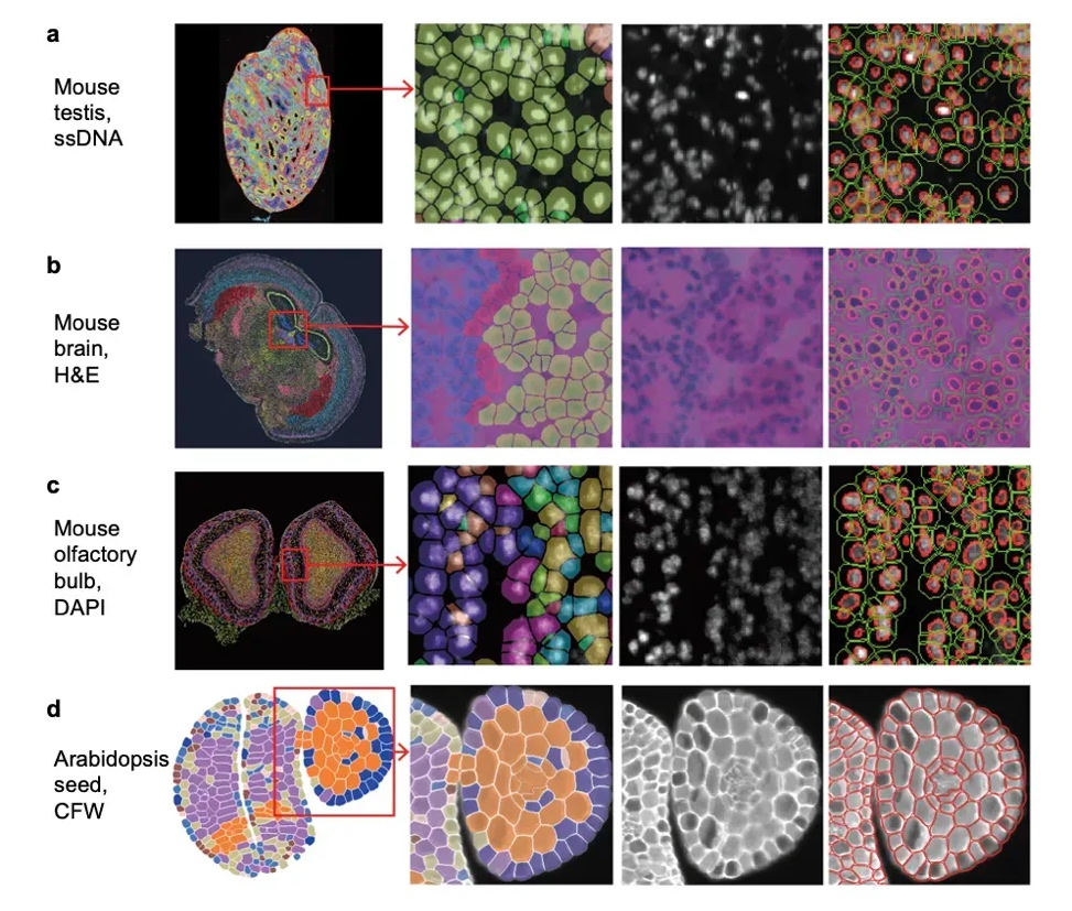 cell_segmentation_Spatial_Transcritomics.webp