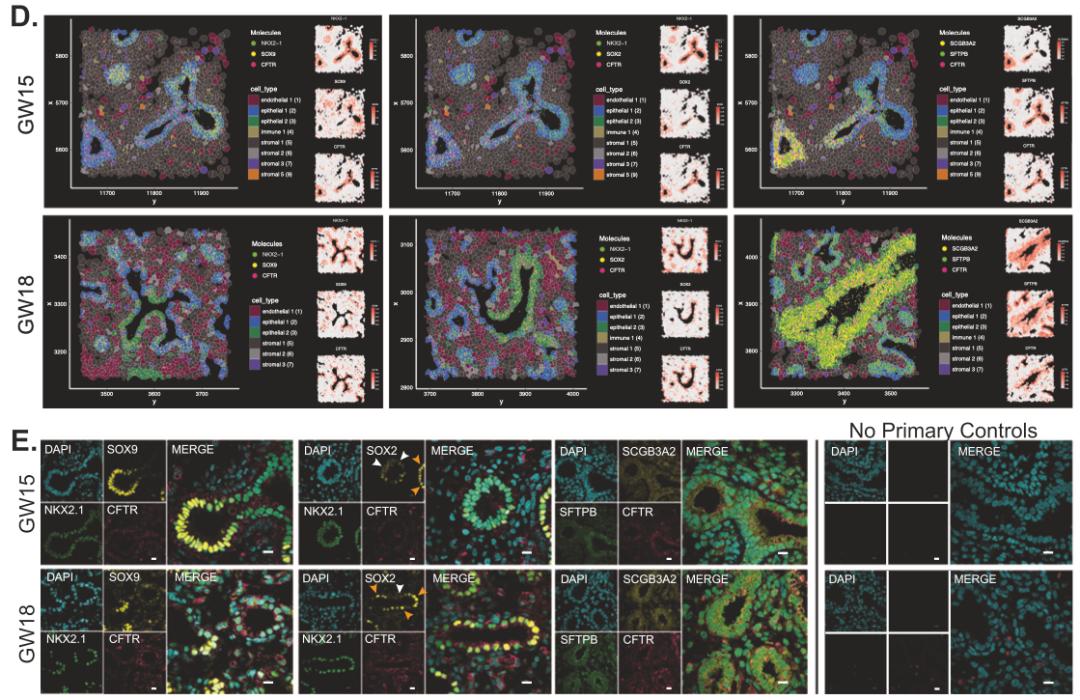 figure-3-spatiotemporal-dynamics-of-cftr-progenitor-cells-during-human-fetal-lung-development.jpg